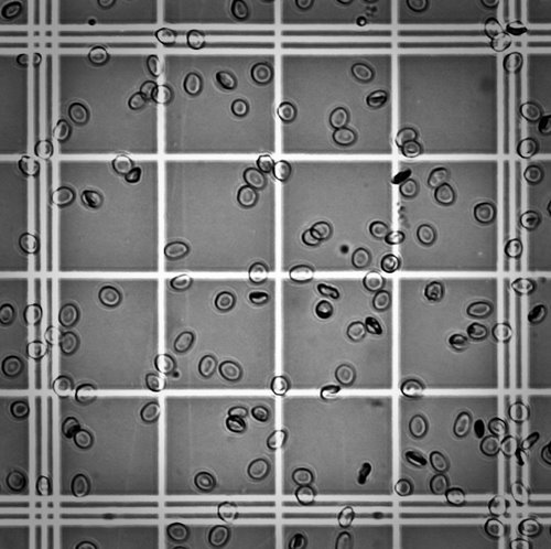 Hemocytometer image - Kim