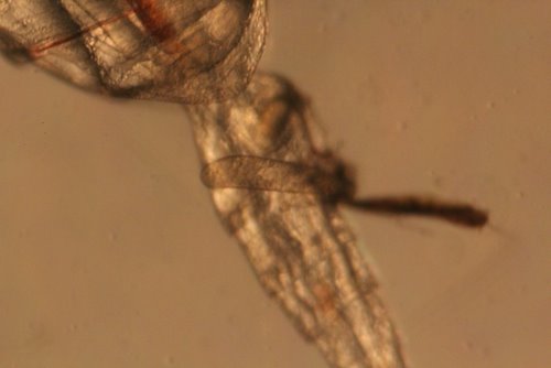 Close up image of the spermatophore attached to the female copepod