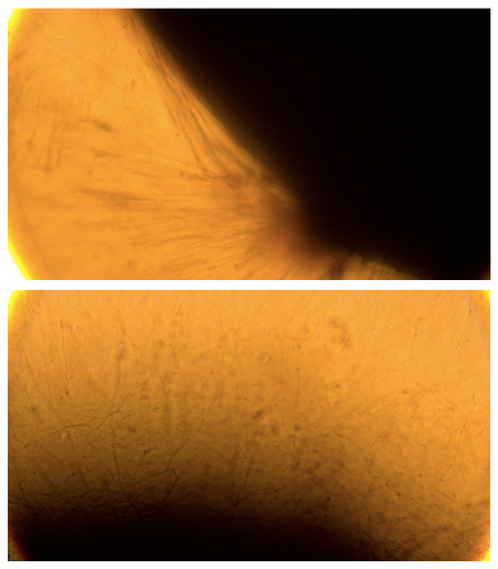 Foraminifera Microscope Psuedopod Closeup