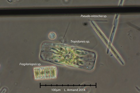 This pictures shows a few species of diatoms with their glass like shells