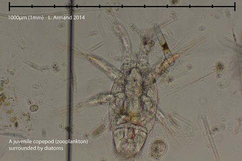 A copepod.A type of zooplankton.