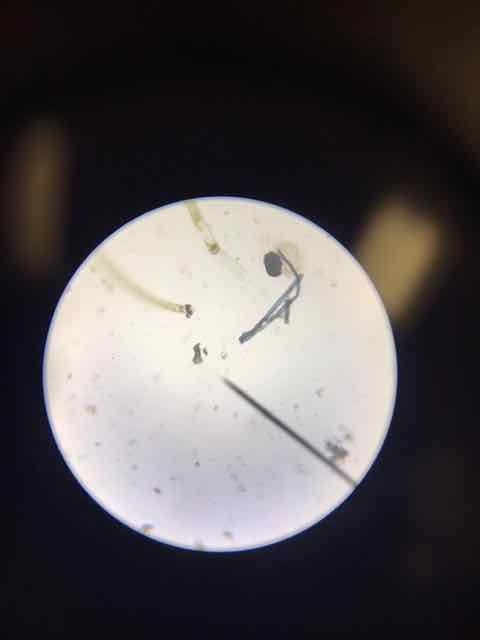 Plankton sample from microscope