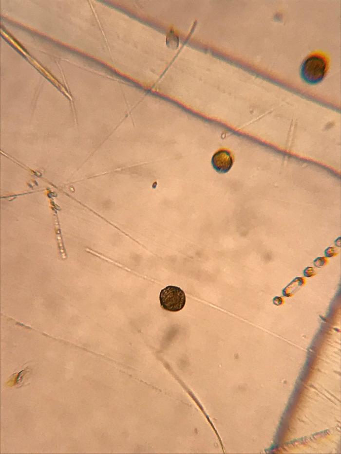 Alexadrium from the Chukchi Sea under a microscope.