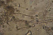 Leptolymbia, a microorganism commonly found in the microbial mats.