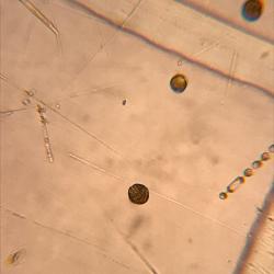 Alexadrium from the Chukchi Sea under a microscope.