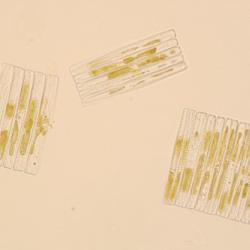 Antarctic diatoms